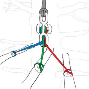 Compréhension de la mise en place du onnecteur Backbone de Notch pour le démontage en élagage